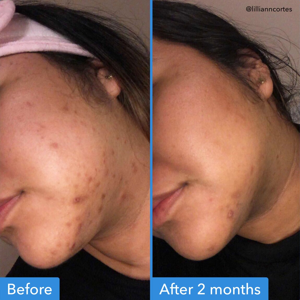 discoloration-correcting-serum-o7 zb_p.jpg