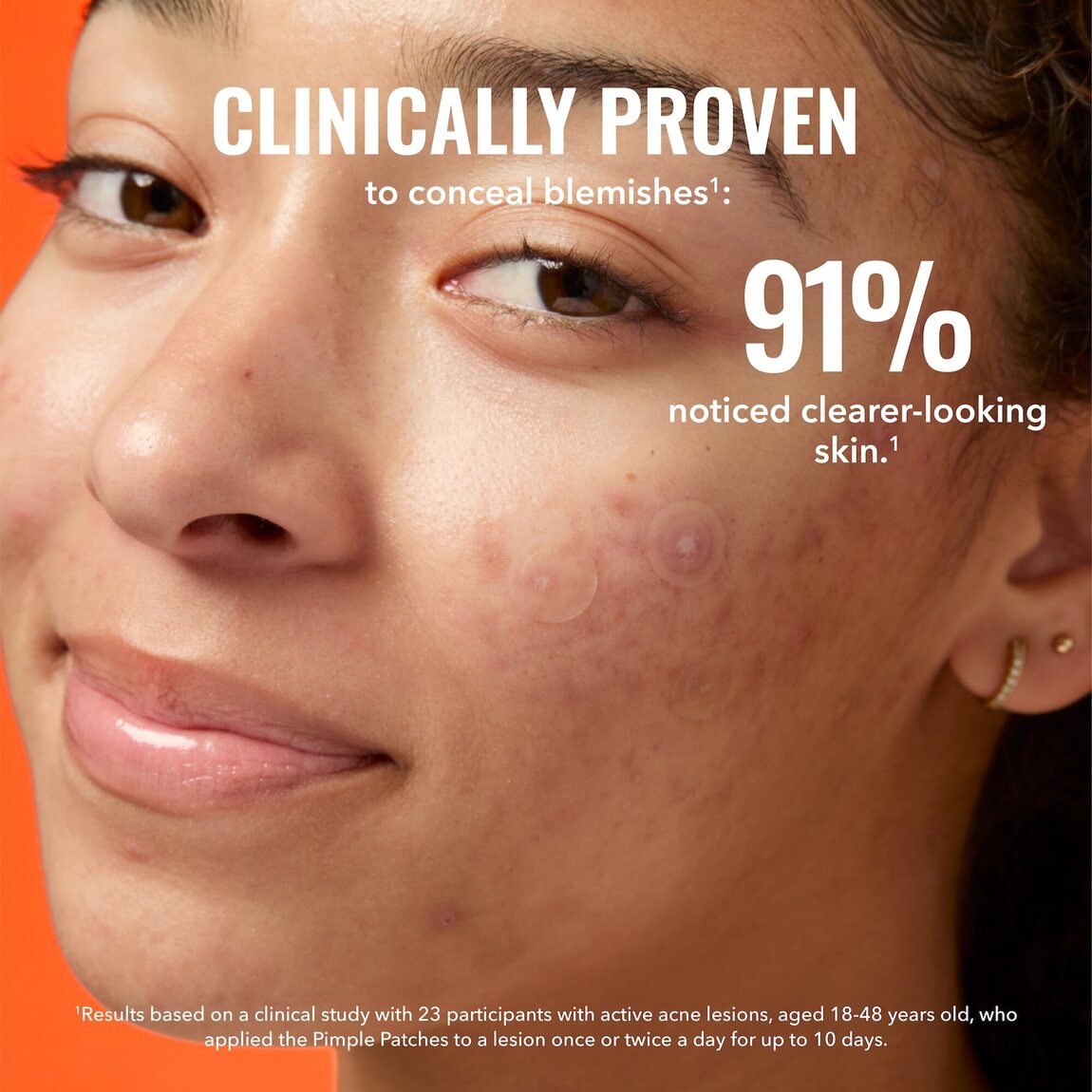 pimple-patches-d9 zb_p.jpg