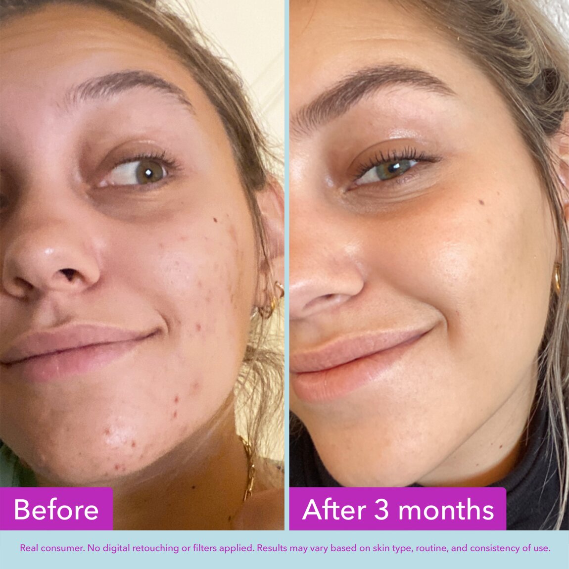 niacinamide-brightening-toner-n9 zb_p.jpg
